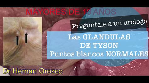 que son las glandulas de tyson|Glándulas de Tyson